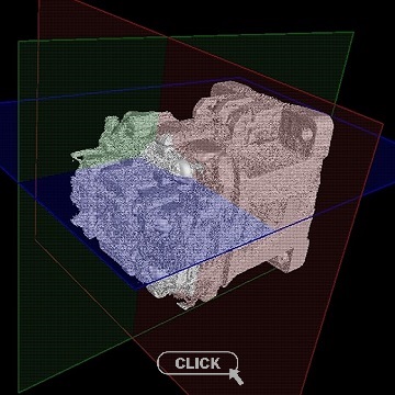 CT解析画像